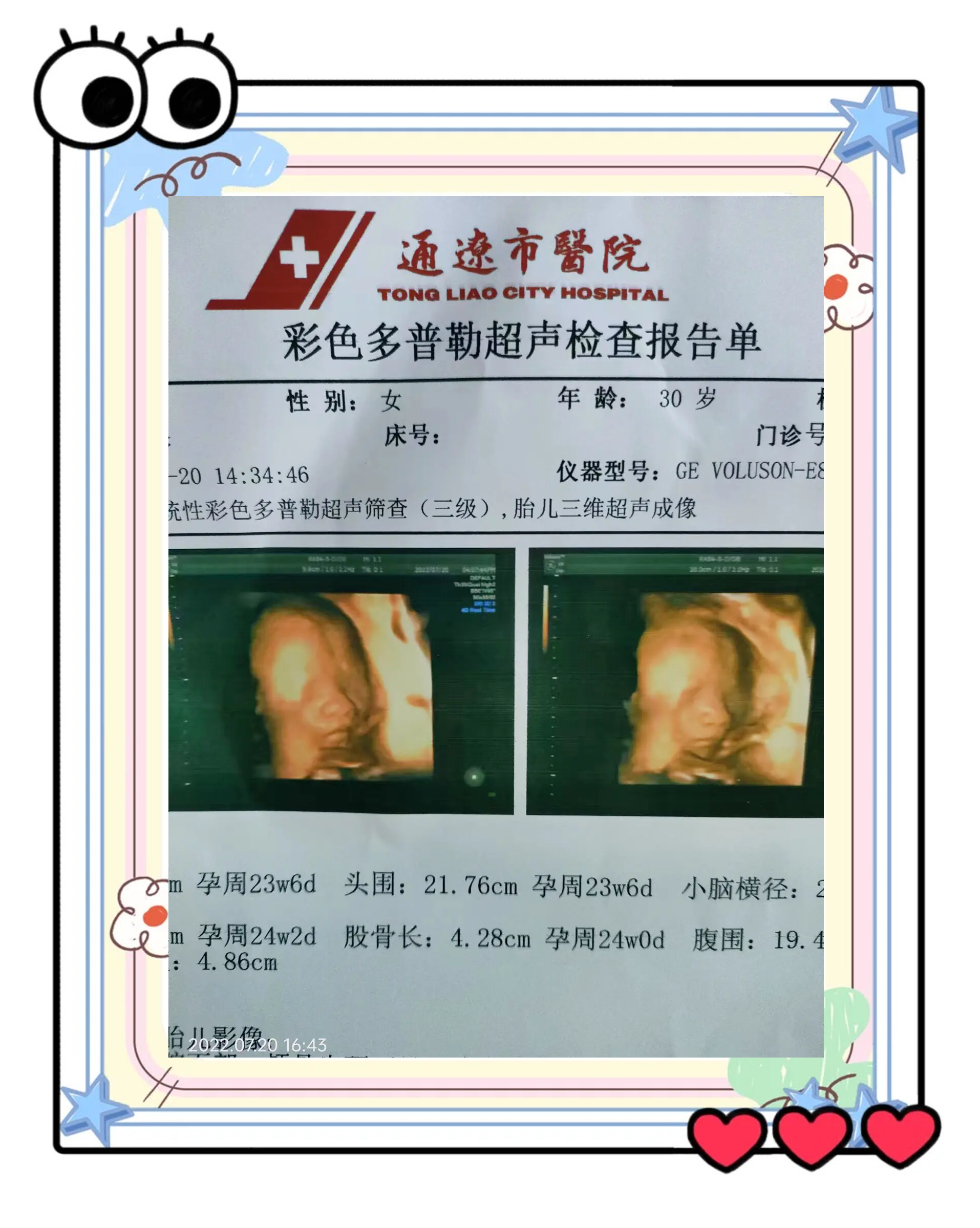 彩超检查什么(彩超检查什么的) 彩超检查什么(彩超检查什么的)